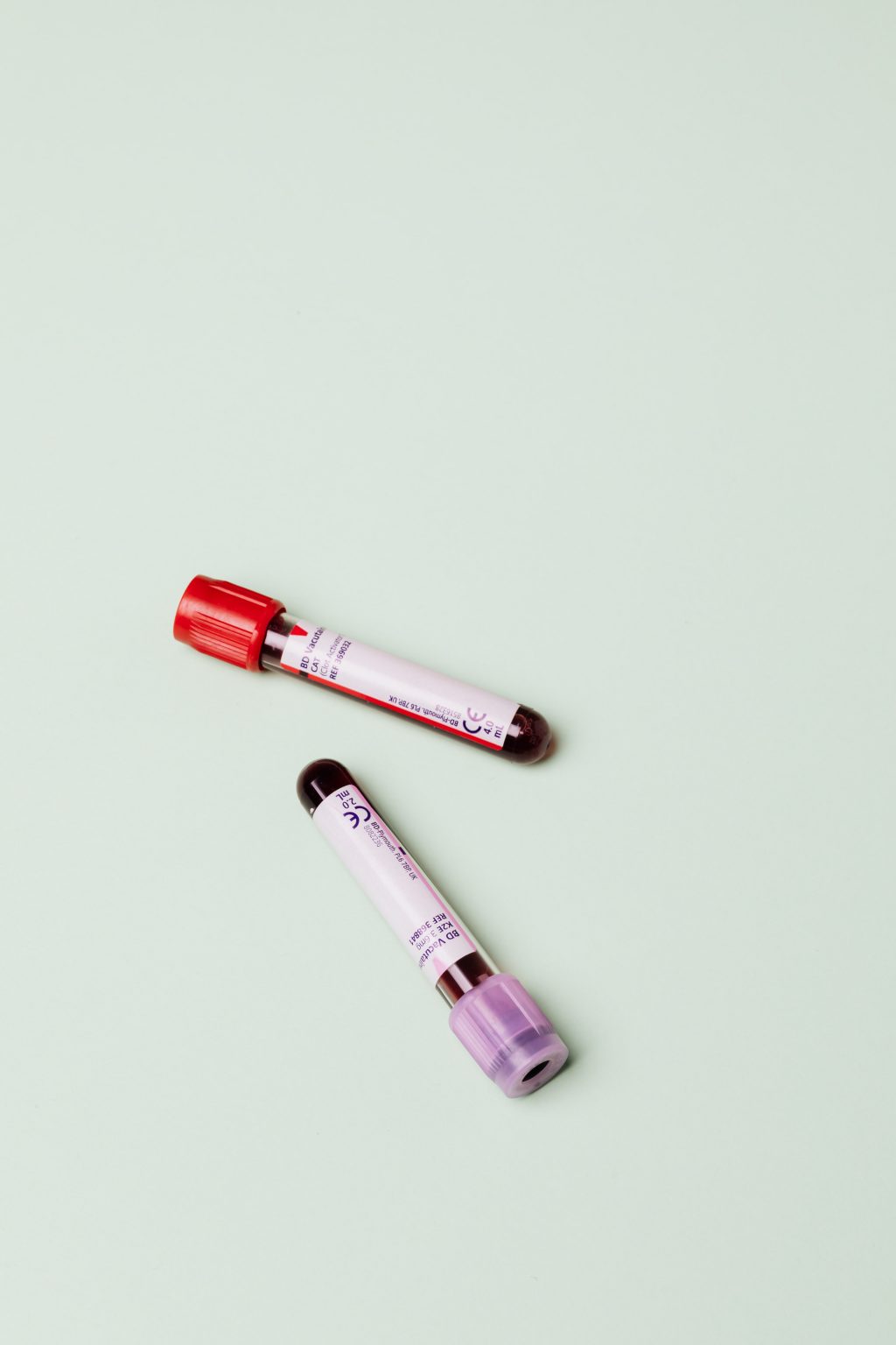 An Ultimate Guide To Major Types Of Blood TestsOnya Magazine an-ultimate-guide-to-major-types-of-blood-testsonya-magazine